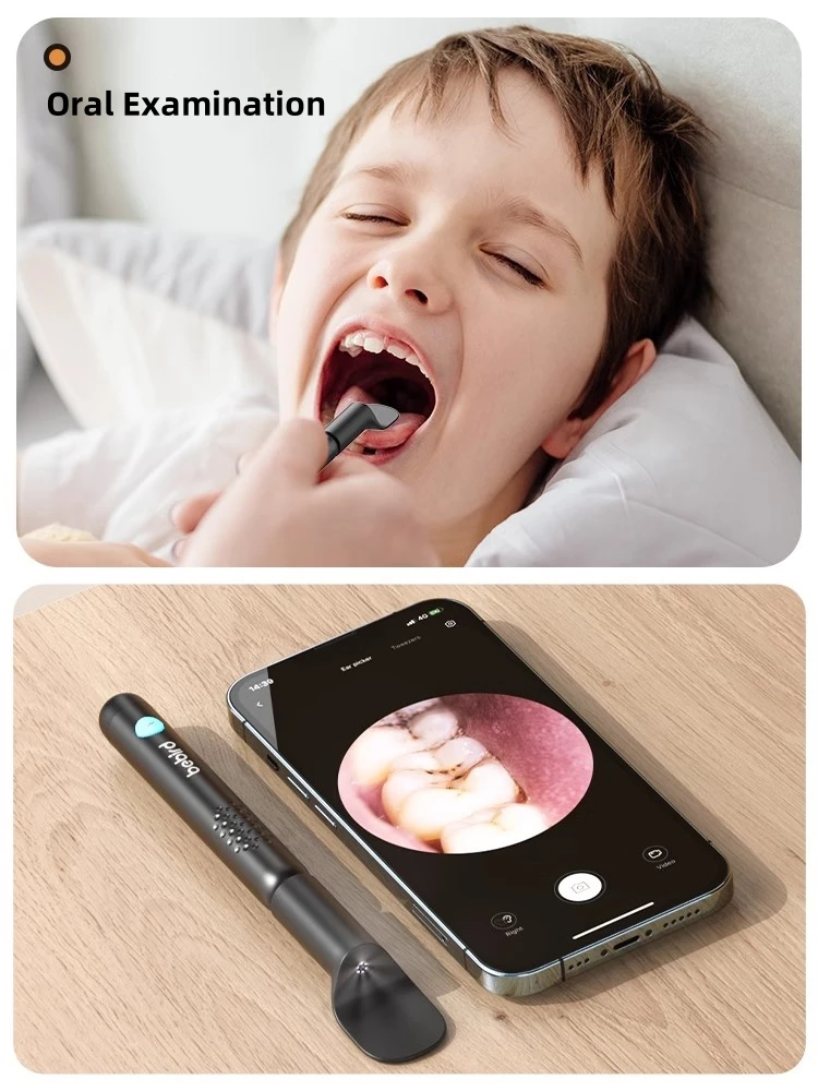 Bebird R3 pembersih telinga Vi - Pet Ear Cleaner ulasan dan harga